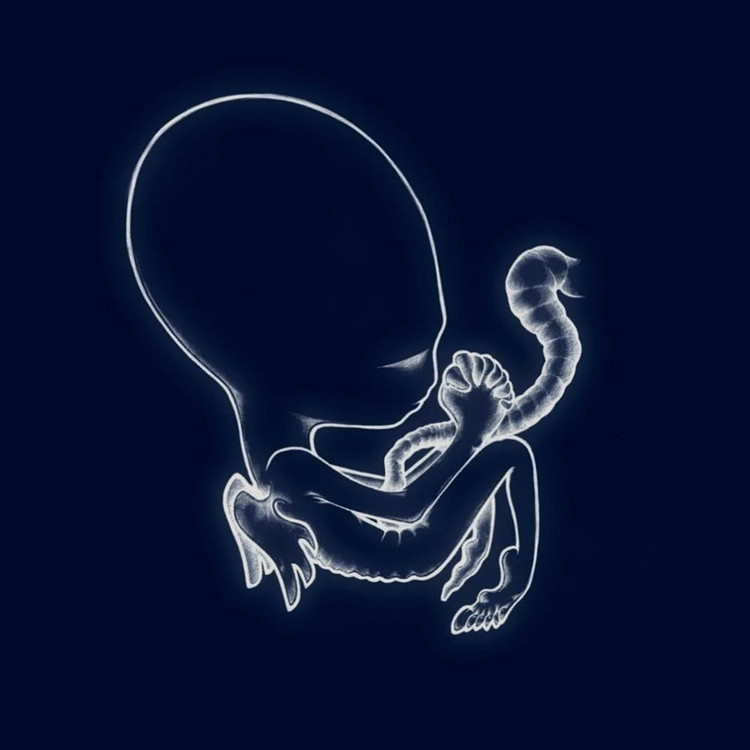 agaetis byrjun
